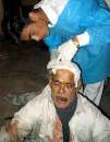 thumb for A victim of a bus incident is treated in a hospital in Muzaffarabad